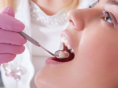 A woman receiving dental care with a dentist wearing purple gloves and holding a drill over her mouth.